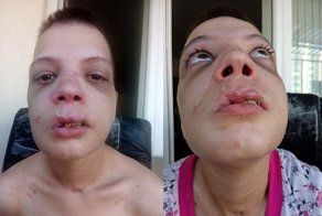 Секс-рабыня показывает травмы, которые она получила от рук болгарских торговцев людьми