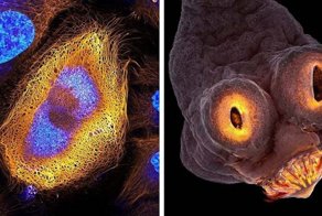 Победители и призеры конкурса Nikon Small World’s 2017