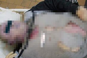 Смерть от шаровой молнии