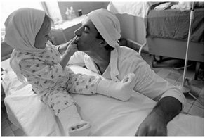 Этой малышке родной отец отрезал обе ноги косилкой. Однако врачи смогли совершить немыслимое