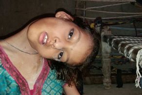 Девочка вынужденна жить с повёрнутой на бок головой