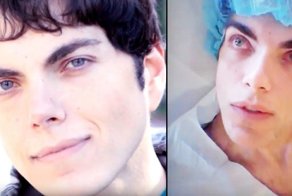 Мужчина не послушался врачей, предупреждавших об опасностях операции по смене цвета глаз, и ослеп