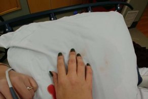 Жена сломала запястье, но не унывает