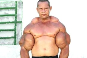 Тестостероновый ответ силиконовым барышням: Как мужчины увеличивают грудь и ещё кое-что