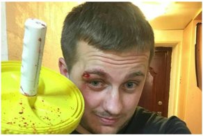 Победители по жизни: на их месте может быть любой из нас