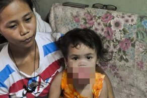 Маленькая девочка может умереть из-за опухоли на языке