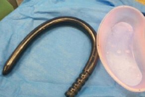 Восстание секс-машин: огромный фаллоимитатор покалечил своего хозяина