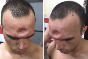 Боксер получил необычную, но очень показательную травму