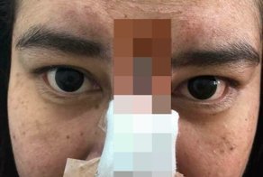 А во лбу дыра горит: опубликованы фотки свежей жертвы пластики