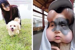 Девушке буквально накачали голову имплантами, чтобы удалить родимое пятно