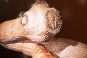 История одного любителя суши, который извлёк из своего организма длиннющего паразита