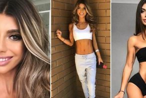 22-летняя девушка с церебральным параличом стала звездой Instagram