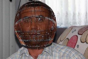 Он закрыл голову в клетке, чтобы бросить курить