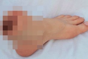 Мужчине прислали вместо обуви вагину в ноге