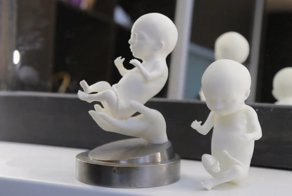 Будущие родители могут напечатать 3d модель своего не рожденного ребенка