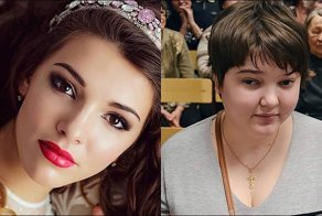 Её жизнь и внешность неузнаваемо изменились после ужасного ДТП