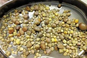 У любителя тофу врачи удалили 420 камней из почек