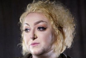 Женщина с избыточным оволосением решила демонстрировать миру свою природную красоту