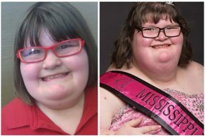 172-килограммовая девушка стала королевой красоты в Миссисипи