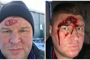 Российский актёр рассказал, откуда у него на лбу взялись отпечатки "лады" и "мерседеса"