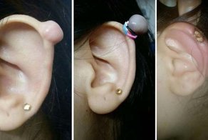 Люди используют резинки для удаления в домашних условиях разного рода дефектов