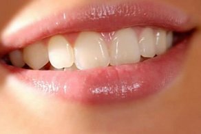 Ученые нашли способ восстанавливать зубы без пломб