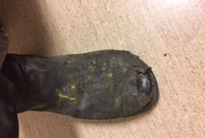 Мужчина лишился части ступни на производстве