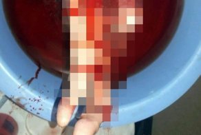 Рыбалка в африканской реке закончилась печально для женщины