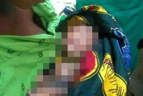 Молодая девушка родила младенца с жутким заболеванием