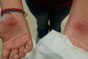 Двое учителей заставляли детей ползать по асфальту в наказание за проступки