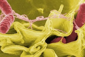 Сальмонелла с измененной ДНК съедает опухоль головного мозга