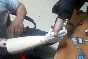 Невероятный момент: мужчина впервые управляет своей бионической рукой силой мысли!