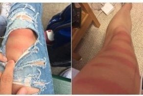 Люди делятся фотографиями идиотского загара, который они получили в рваных джинсах