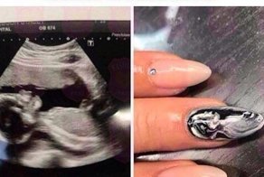 Овуляшка - это состояние души: будущие яжематери беснуются в интернете