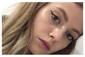 Как Меган: Instagram заполонили фейковые веснушки