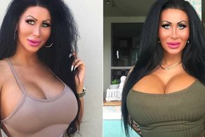 Берлинская Барби осчастливила себя гигантской грудью