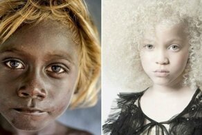 20 фотографий людей, которых вселенная наградила поистине нестандартной внешностью