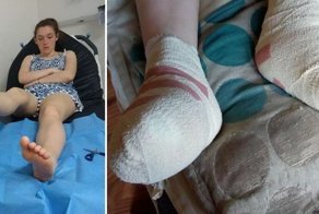 Девушка показала насколько опасны прогулки по горячему песку