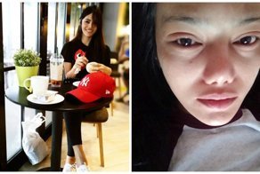 Неопытный косметолог заклеила глаза клиентке