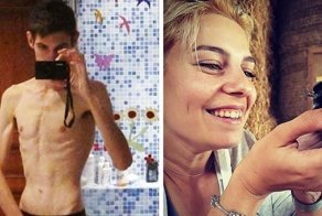 Француз много лет болел анорксией, пока не встретил свою любовь. И это спасло ему жизнь