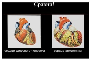 Не пей - козленочком станешь: бутылки спиртного хотят украсить жуткими фотографиями