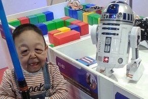 Шестилетнему мальчику сделают подтяжку лица