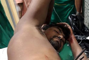 Каменщик чудом выжил после того, как его прокололи три железных прута