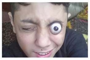 В Пакистане нашли ну очень пучеглазого парня: видео