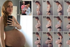 Родить тройню: будущая мама отчитывается о нелегкой миссии