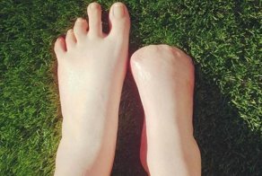 Спа из ада: девушка лишилась пальцев на ноге после пилинга рыбками в Таиланде