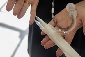 45-летний британец получил бионический пенис и смог впервые заняться сексом