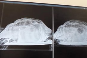 Врачи извлекли мертвую черепаху из молодой британки