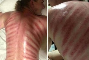 На Бали из австралийского туриста сделали "красного дракона"