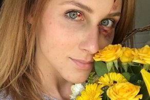 Парень наказал свою девушку за фотографию в Instagram